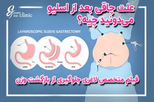 علت چاقی بعد از عمل اسلیو معده و روش‌های جلوگیری