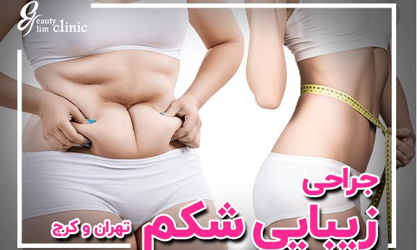 در این مقاله، با انواع جراحی زیبایی شکم، شامل لیپوساکشن و ابدومینوپلاستی در کلینیک اسلیم بیوتی آشنا شوید. نکات مهم، روش‌ها و مشاوره رایگان بهبود ظاهر