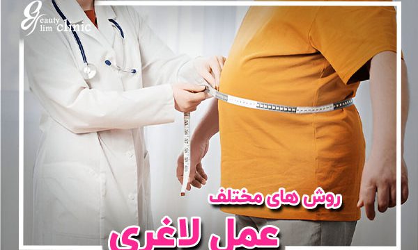 جراحی‌ لاغری، شامل اسلیو معده، بای‌پس معده و سایر روش‌های موثر کاهش وزن در کلینیک اسلیم بیوتی آشنا، اطلاعات جامع و مشاوره‌های رایگان کلینیک اسلیم بیوتی بای پس