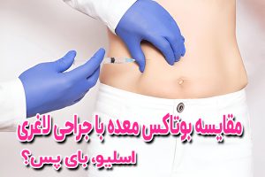 ✅مقایسه بوتاکس معده و جراحی های لاغری(بای‌پس و اسلیو معده) مقایسه بوتاکس معده/ اسلیو/بای‌پس معده؟ کدام روش برای کاهش وزن مؤثرتر است؟ این مقاله از کلینیک اسلیم بیوتی، تفاوت‌ها، مزایا و معایب این دو روش را بررسی کرده‌ایم