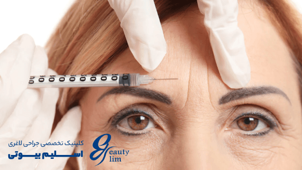 نقاط تزریق بوتاکس