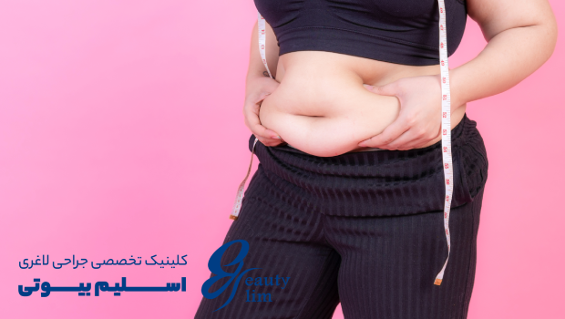 بازگشت وزن بعد از اسلیو معده