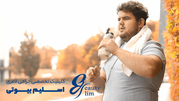 تجربه بیماران از ورزش بعد از اسلیو معده