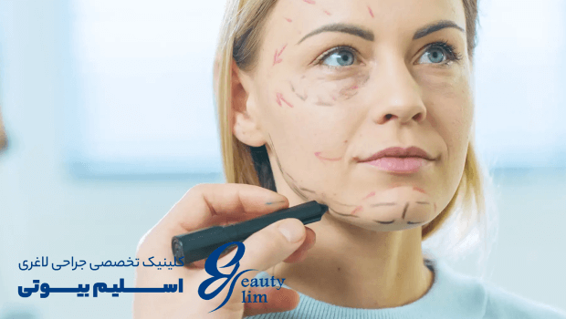 علت لاغری صورت بعد از اسلیو معده