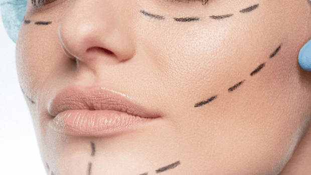 لاغری صورت بعد از اسلیو