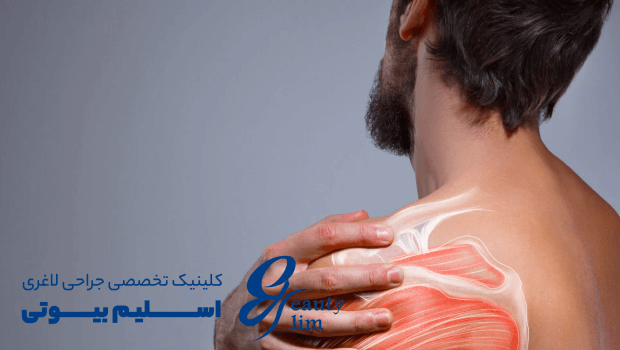 درمان درد شانه بعد از اسلیو معده