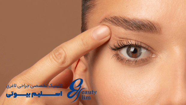 بلفاروپلاستی یا لیفت شقیقه