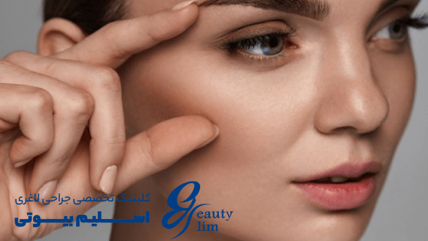 بلفاروپلاستی