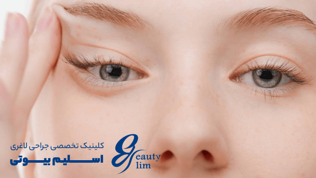 مراقبتهای قبل از لیفت شقیقه