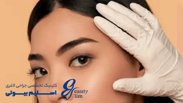 لیفت شقیقه چیست