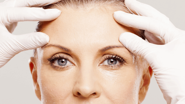 ماندگاری لیفت شقیقه