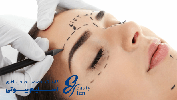 لیفت شقیقه چیست