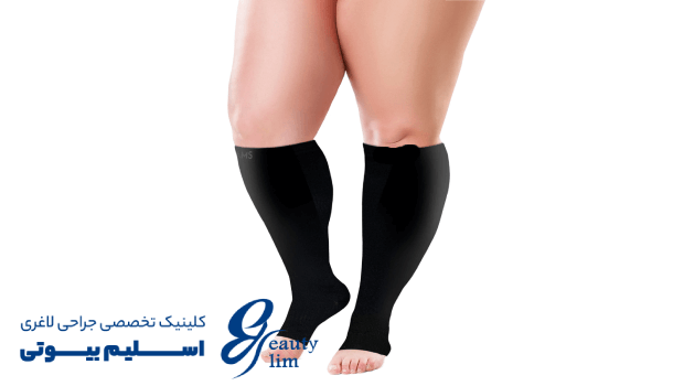 اهمیت جوراب واریس بعد از اسلیو معده