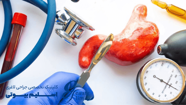 بهترین جراح اسلیو معده در تهران