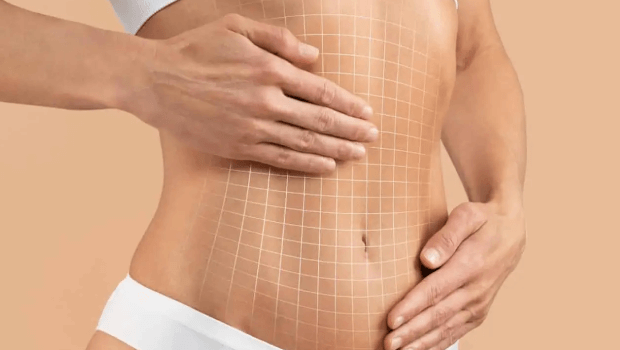 دوران نقاهت ابدو همراه با سزارین چقدر است؟