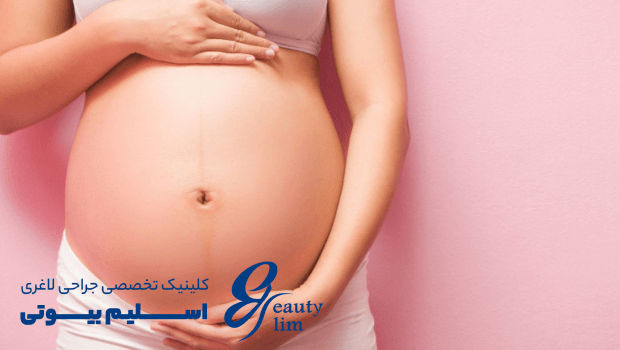 زایمان بعد از اسلیو