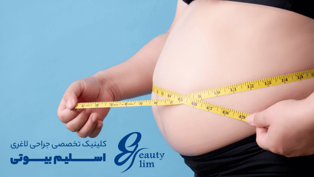 بهترین زمان بارداری بعد از اسلیو