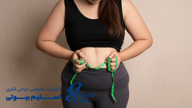 گشاد شدن معده بعد از عمل اسلیو