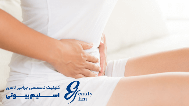 گشاد شدن معده بعد از اسلیو معده