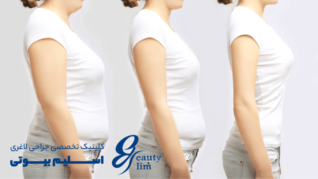 آیا یائسگی باعث لاغری می‌شود