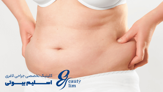 یائسگی و چاقی