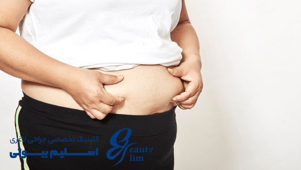 درمان چاقی بعد از یائسگی