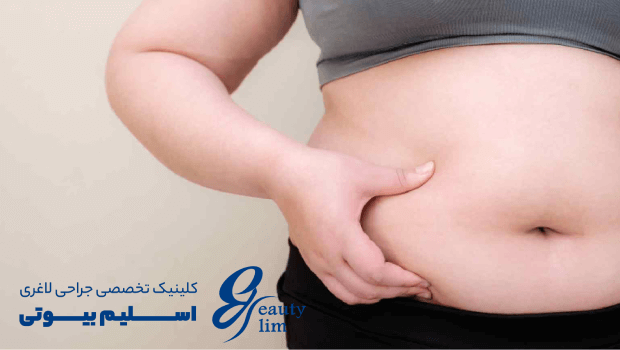 آیا کته برنج چاق‌ کننده است؟