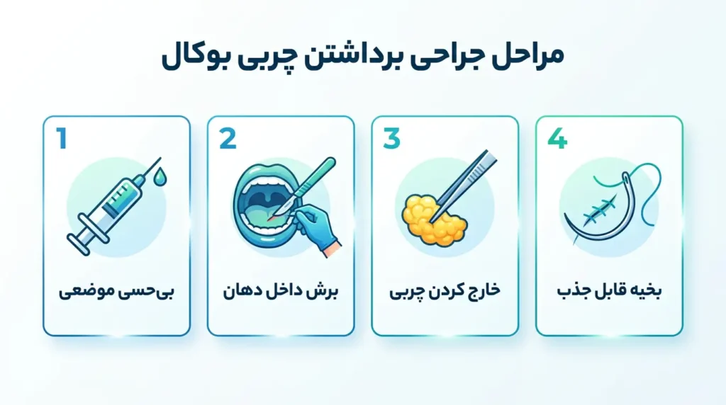 اینفوگرافیک مراحل جراحی بوکال فت