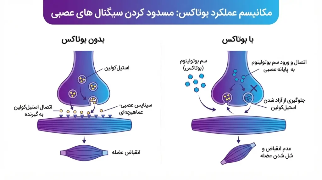 نحوه عملکرد بوتاکس در مسدود کردن سیگنالهای عصبی