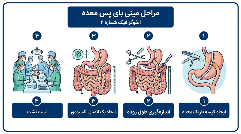 مراحل-عمل-مینی-بای-پس (1)