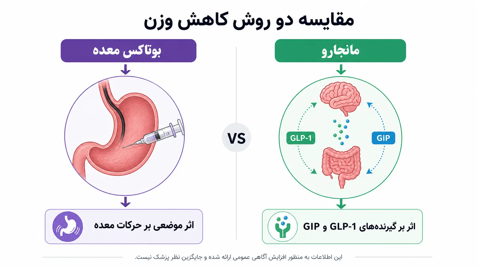 اینفوگرافیک تفاوت مکانیسم اثر بوتاکس معده و مانجارو