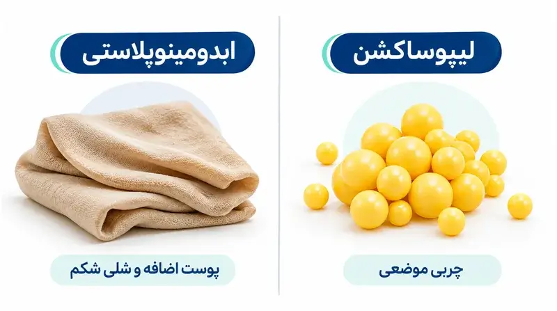 اینفوگرافیک تفاوت ابدومینوپلاستی برای پوست اضافه با لیپوساکشن برای چربی موضعی